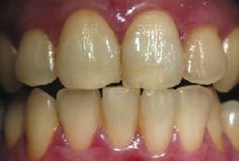 Before